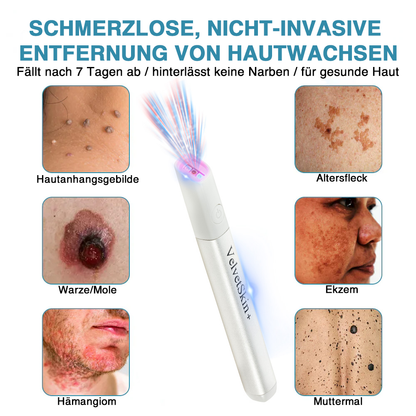 🇩🇪Bikenda® VelvetSkin+ All-in-One Laser Eraser Pen (mit CO₂-Lasertechnologie - entfernt effektiv Muttermale, Warzen, Hautanhängsel, Pigmentflecken und andere Hautunreinheiten)