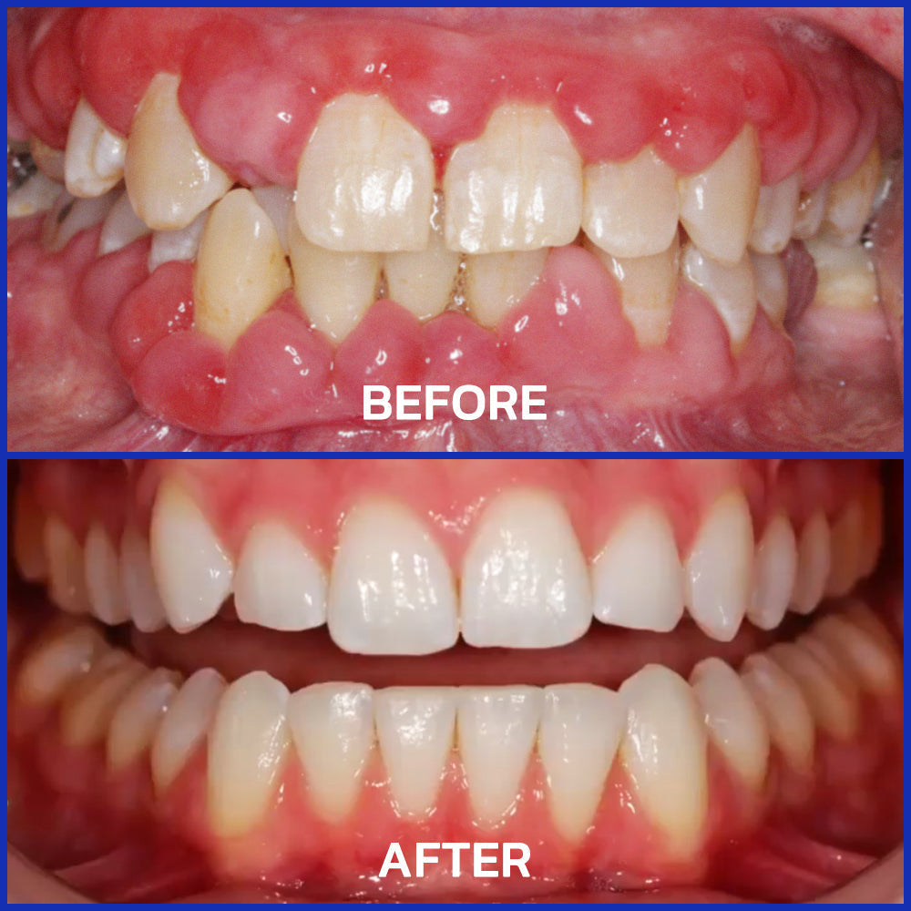 Cougex® VioGloss Bee Venom Dental Therapy Oral Power