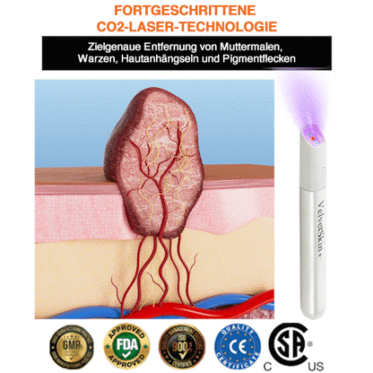 🇩🇪Bikenda® VelvetSkin+ All-in-One Laser Eraser Pen (mit CO₂-Lasertechnologie - entfernt effektiv Muttermale, Warzen, Hautanhängsel, Pigmentflecken und andere Hautunreinheiten)